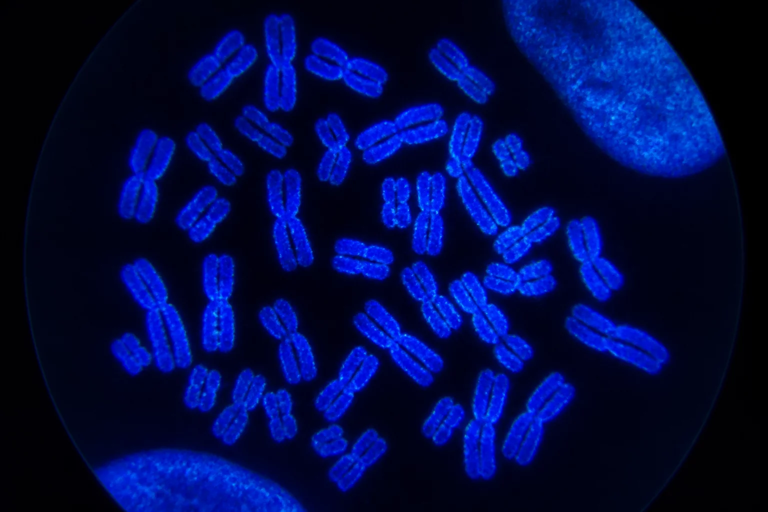 Chromosomes Under Laboratory Microscope
